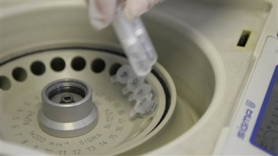 تحور أم سلالة جديدة؟ .. علماء يوضحون تفاصيل التطور الجديد للفيروس المرعب 