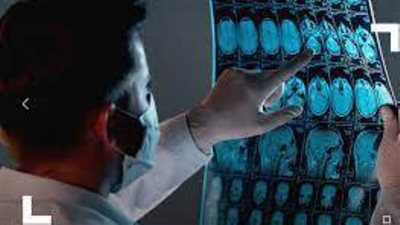  القاتلة.. دراسة تكشف تورّط الدماغ في تطوير 