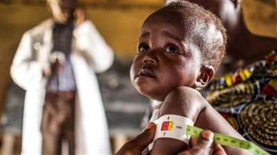 لمكافحة سوء التغذية ..إطلاق صندوق الأمم المتحدة الاستئماني 