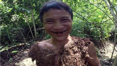  وفاة «رجل الغابة» الفيتنامي بعد 40 عامًا من العيش في الأدغال