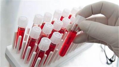 قبل الموجة الرابعة لـ«كورونا».. 7 تحاليل هامة للاطمئنان على الجهاز المناعي.. تعرف عليها  