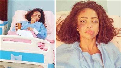 تحرك قانوني ضد دوللي شاهين بعد ادعاء تعرضها للضرب من مجهولين