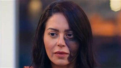 لقاء الخميسي عقب ظهورها بوحمة في 