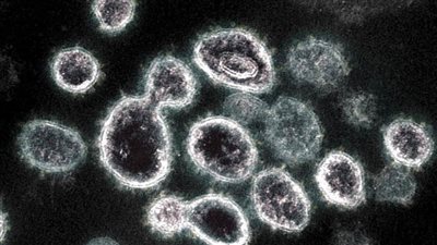 لأول مرة.. رصد إصابة 