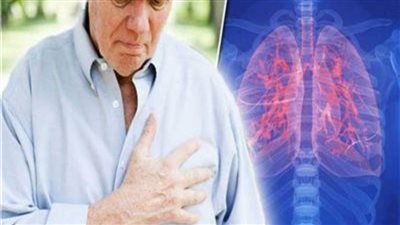 «دراسة»: التدخين السبب الأكثر شيوعا في سرطان الرئة
