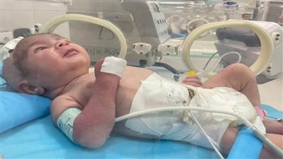 «الصحة» تتعاون مع التعليم العالي لإنقاذ حياة طفل حديث الولادة (صور)