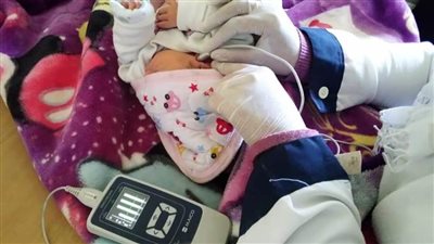 الصحة: فحص 3 ملايين و856 ألف طفل ضمن مبادرة رئيس الجمهورية للكشف المبكر وعلاج ضعف وفقدان السمع