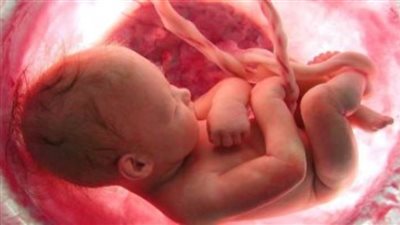 الجمعية الوطنية الفرنسية تدرج حق الإجهاض فى الدستور بعد سنوات من الجدل