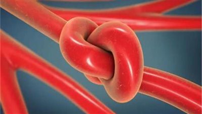 علماء يختبرون نظام جلطات لوقف النزيف الداخلي أثناء التعرض لحوادث سير 