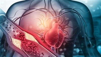الذكاء الاصطناعي يساعد في الإسراع بتشخيص النوبات القلبية 