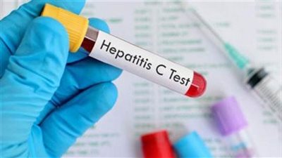 أعراض فيروس سي وطرق الحماية والعلاج 