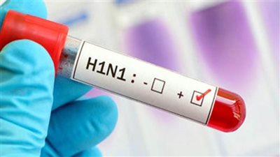 حقيقة رصد إصابات بسلالات جديدة من إنفلونزا الخنازير في مصر