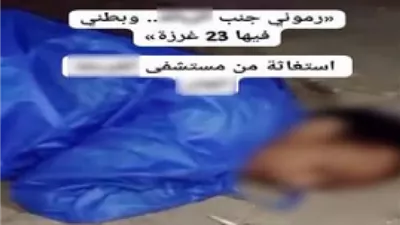 حقيقة فيديو طرد مريض مصاب بالإيدز من مستشفى بالغردقة.. شقيقه يكشف التفاصيل
